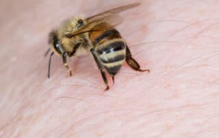bee-sting-pest-control-company-anaheim-hills-orange-county-ca